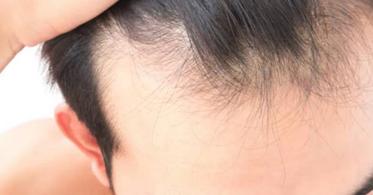 Cómo prevenir la caída del cabello: rutina fácil